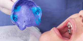 Periodontologia - co warto o niej wiedzieć